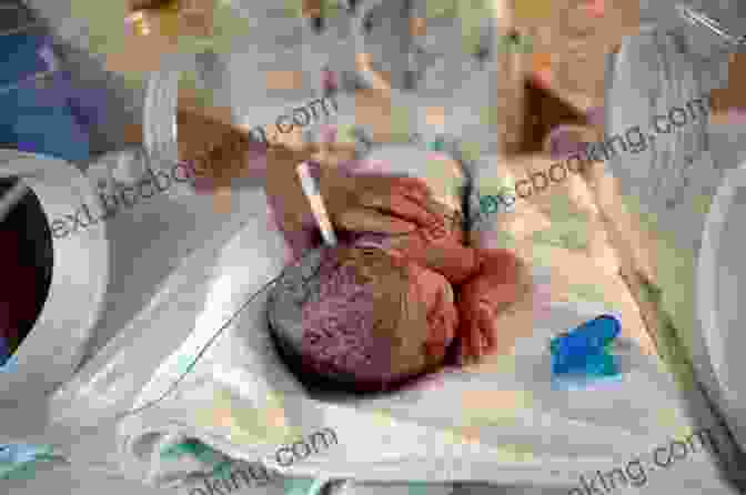 A Preterm Infant In The NICU. Kangaroo Care: The Best You Can Do To Help Your Preterm Infant